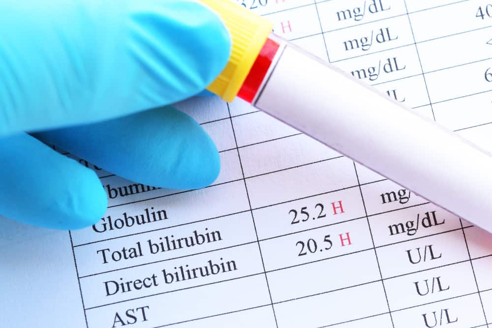 Bilirubin dan Pemeriksaan Bilirubin