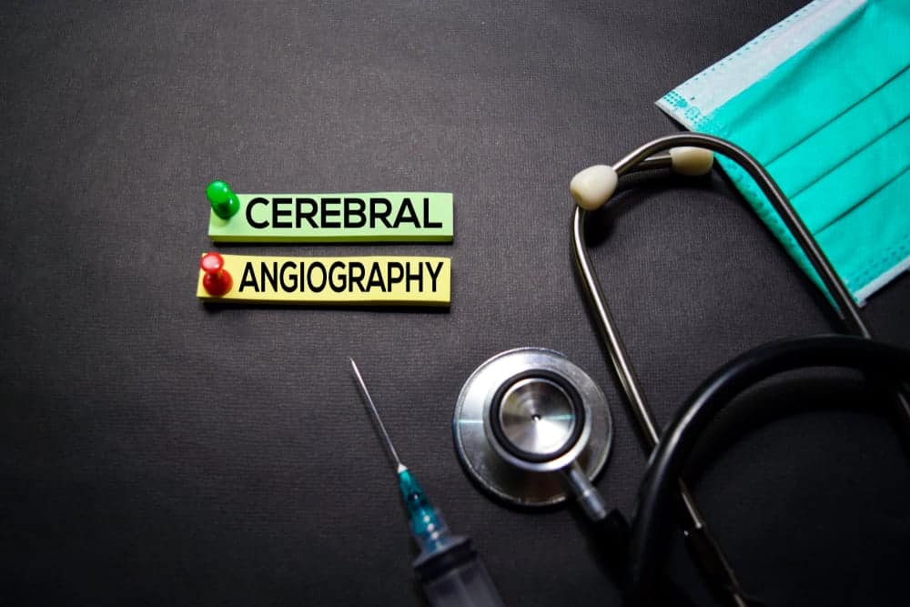 Cerebral Angiogram