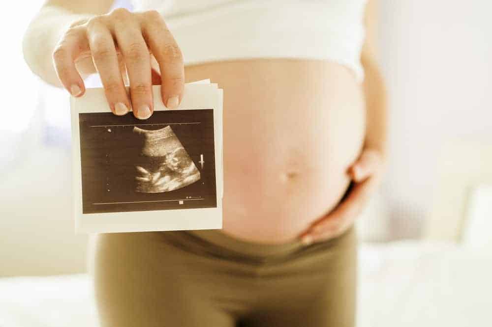 Agar Lebih Akurat, Begini Cara Membaca Hasil USG Kehamilan