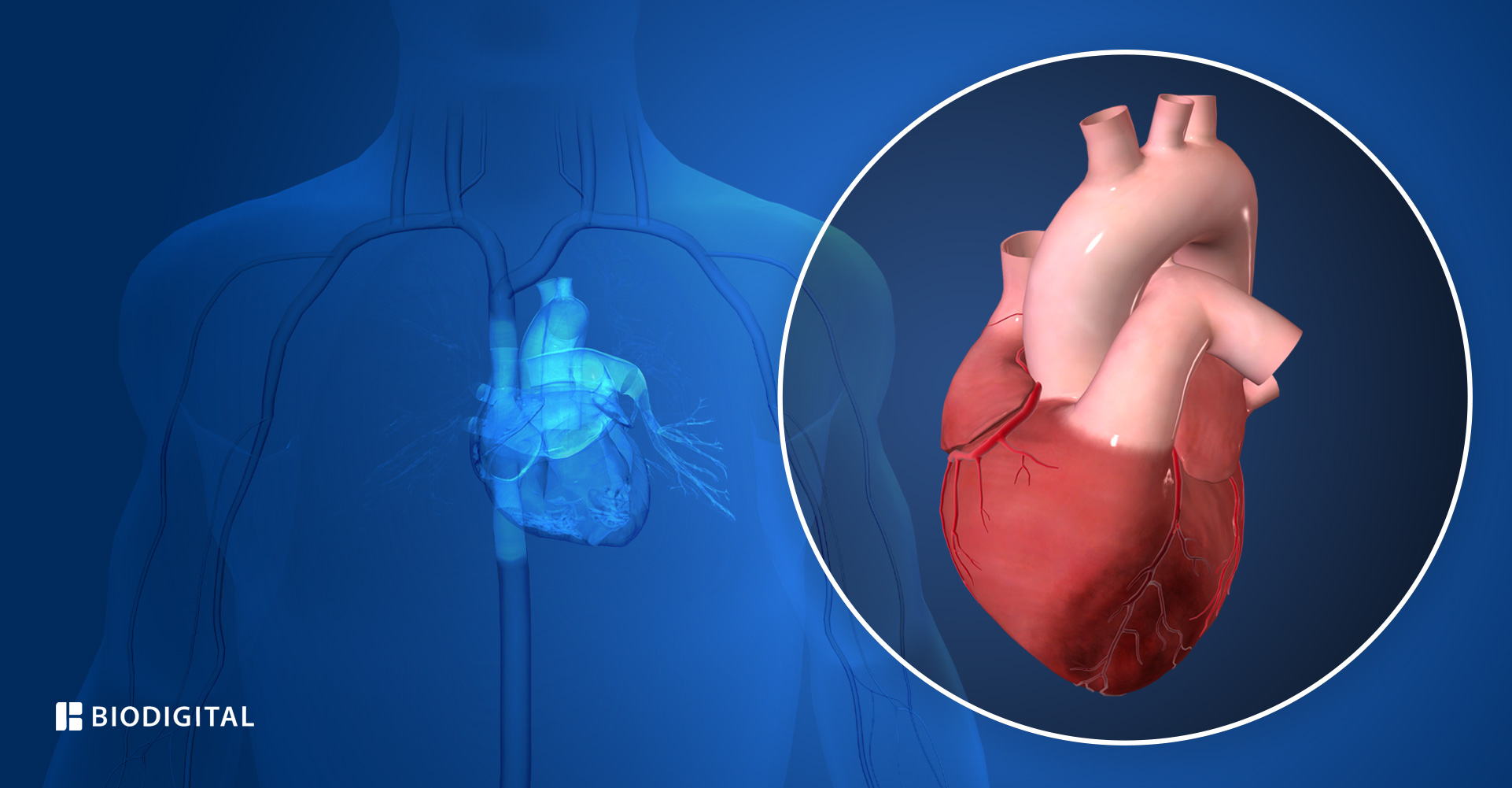 Berbagai Penyebab Serangan Jantung yang Penting Diketahui