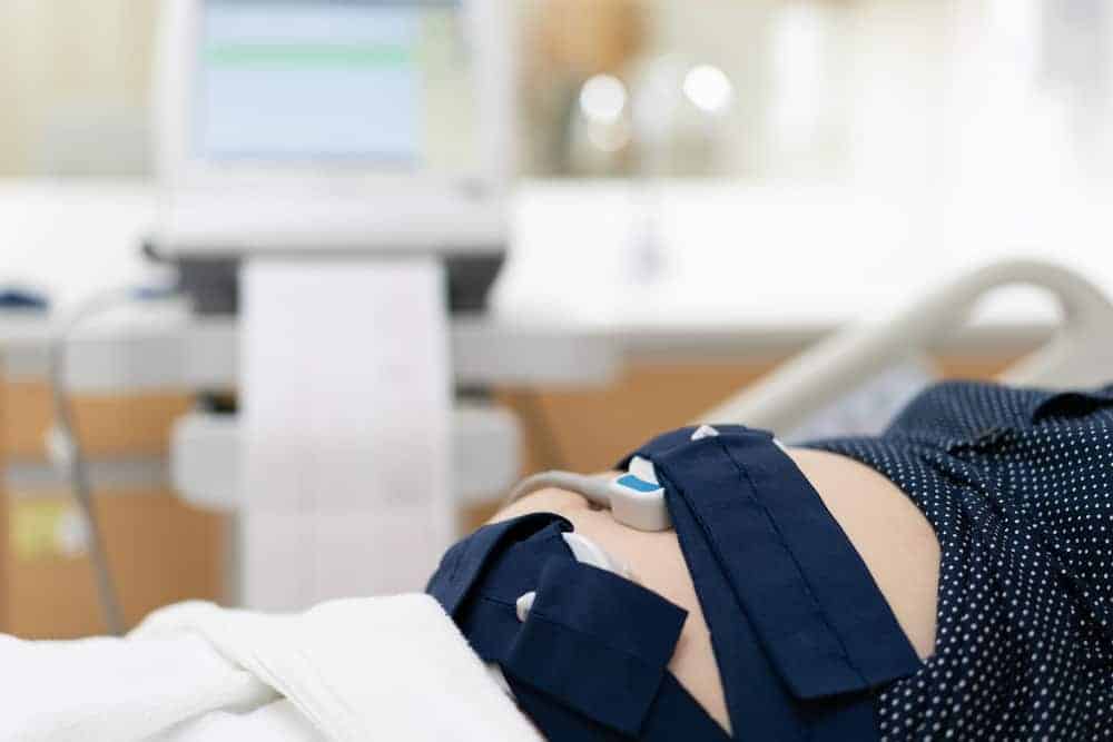 Mengenal Cardiotocography (CTG), Pemeriksaan Detak Jantung Bayi di dalam Kandungan