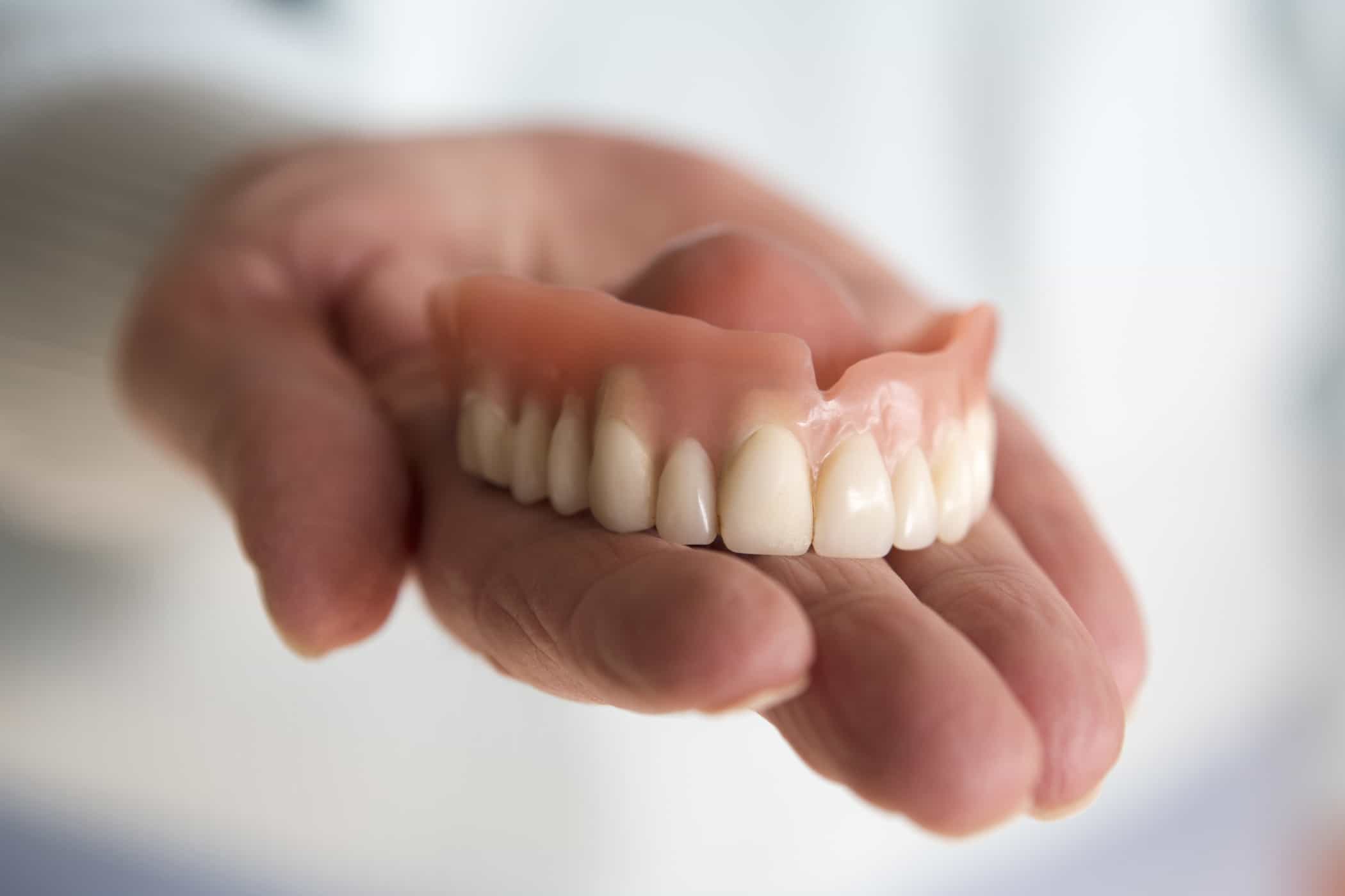 Proses Pemasangan Gigi Palsu Lepasan dari Awal hingga Akhir