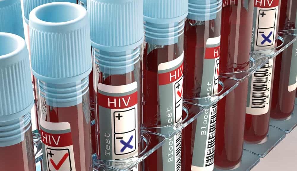 Tips Melindungi Diri dari COVID-19 bagi Penderita HIV dan AIDS