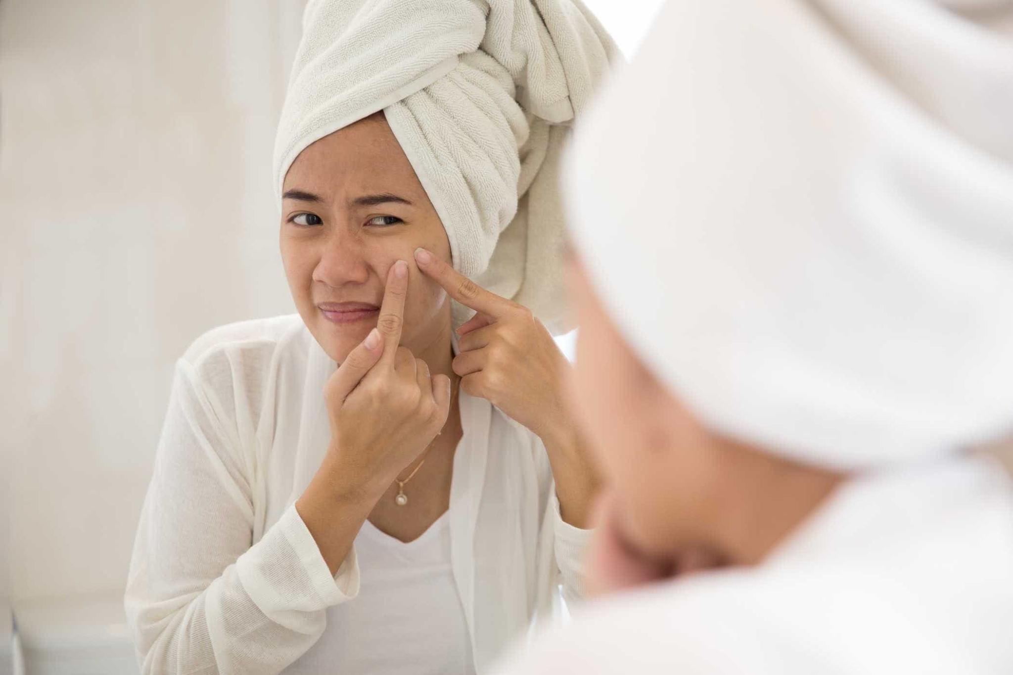 Cara Menghilangkan Jerawat, dari Obat Hingga Alami