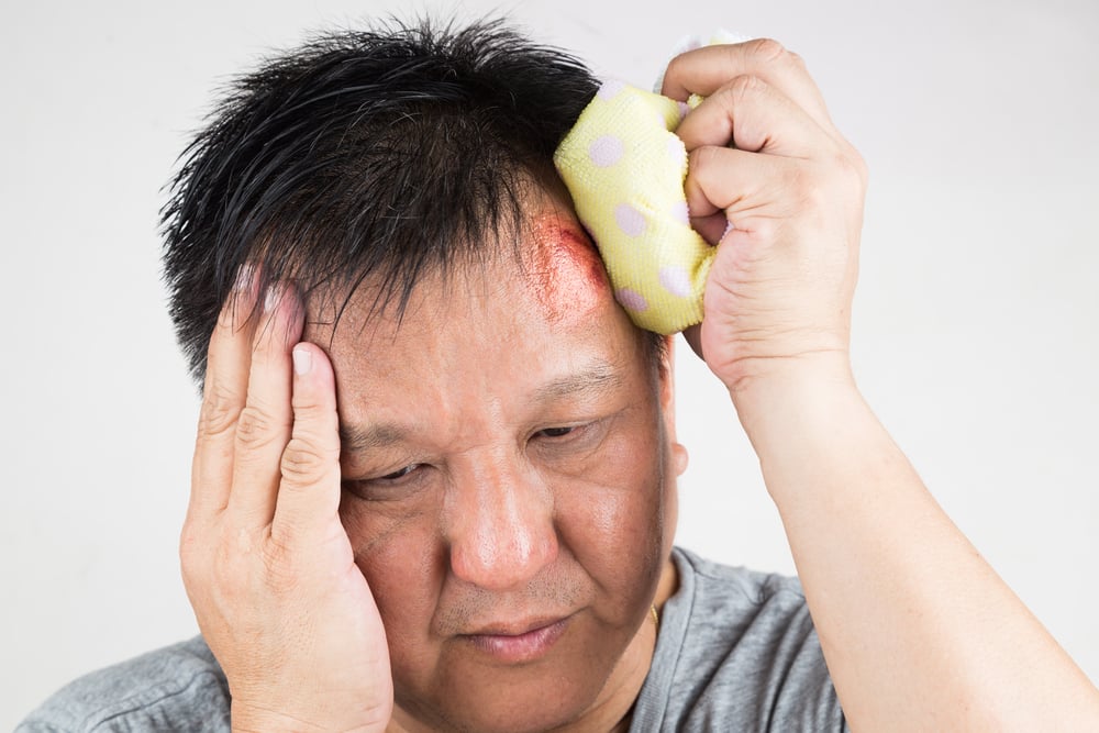 6 Kondisi Kesehatan yang Mungkin Jadi Penyebab Benjolan di Kepala