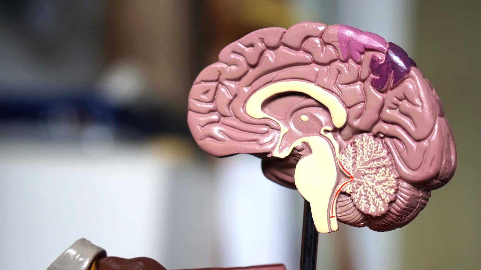 Lobotomi, Prosedur Bedah Otak untuk Tangani Gangguan Jiwa