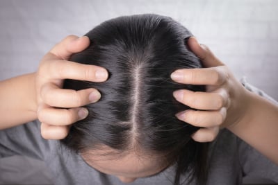 cara menghilangkan kutu di rambut secara alami