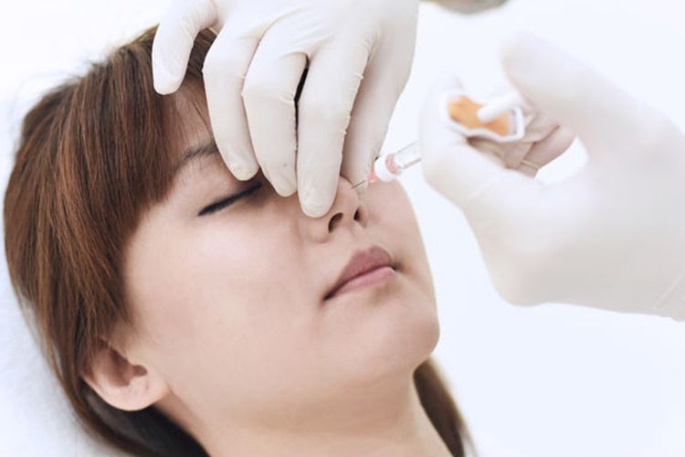 Memahami Septorhinoplasty, Operasi Plastik untuk Hidung