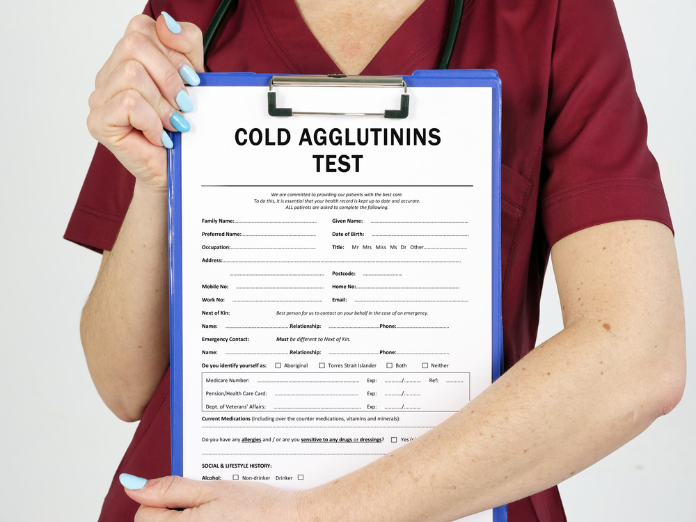 Aglutinin Dingin, Tes untuk Deteksi Penyebab Penyakit