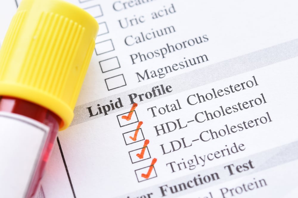 Informasi Lengkap tentang Persiapan, Prosedur, Hingga Hasil Tes Kolesterol