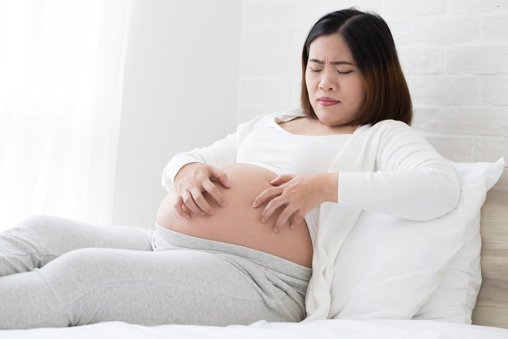 Perubahan kulit pada ibu hamil