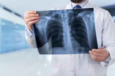 diagnosis pemeriksaan sesak napas