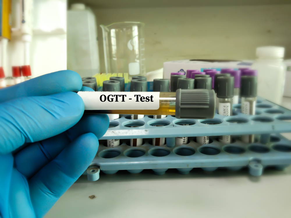 Tes Toleransi Glukosa Oral (TTGO) untuk Diagnosis Diabetes