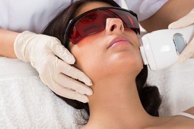 laser hair removal