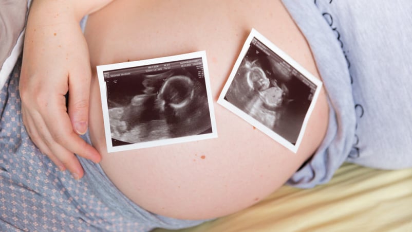 kehamilan 41 minggu