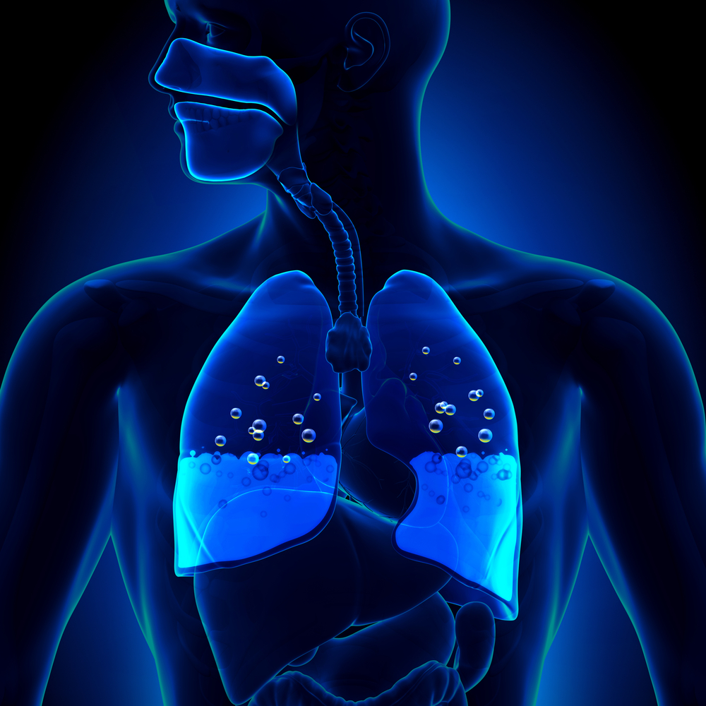 Kondisi paru-paru mengalami pembengkakan terjadi pada orang yang memiliki gangguan penyakit