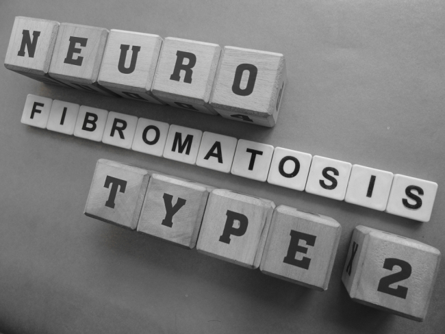 Neurofibromatosis Tipe 2