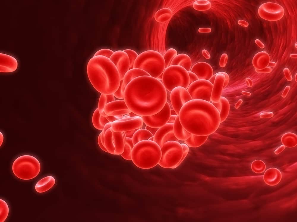 Disseminated Intravascular Coagulation (DIC)