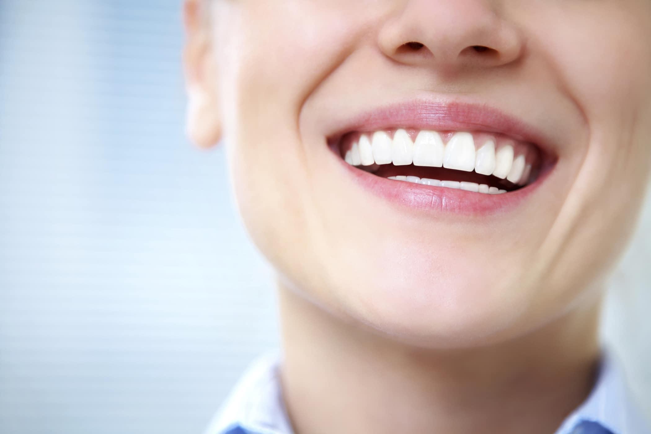 Fluorosis