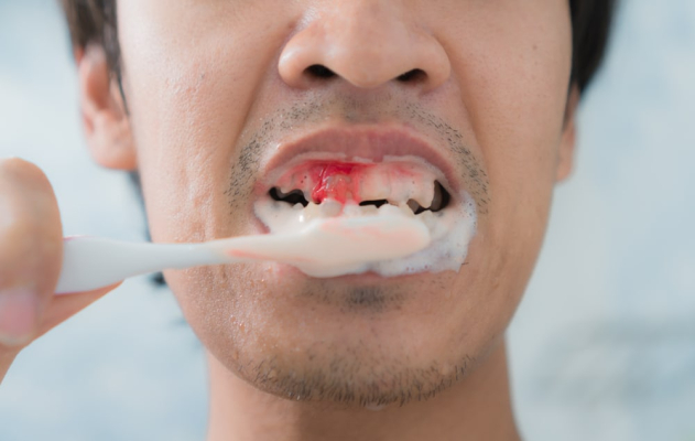 infeksi gusi karena gigi berlubang di malaysia