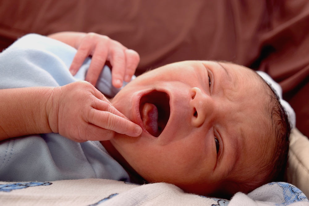 Kenali Tongue Tie (Ankyloglossia) yang Bikin Bayi Sulit Menyusu