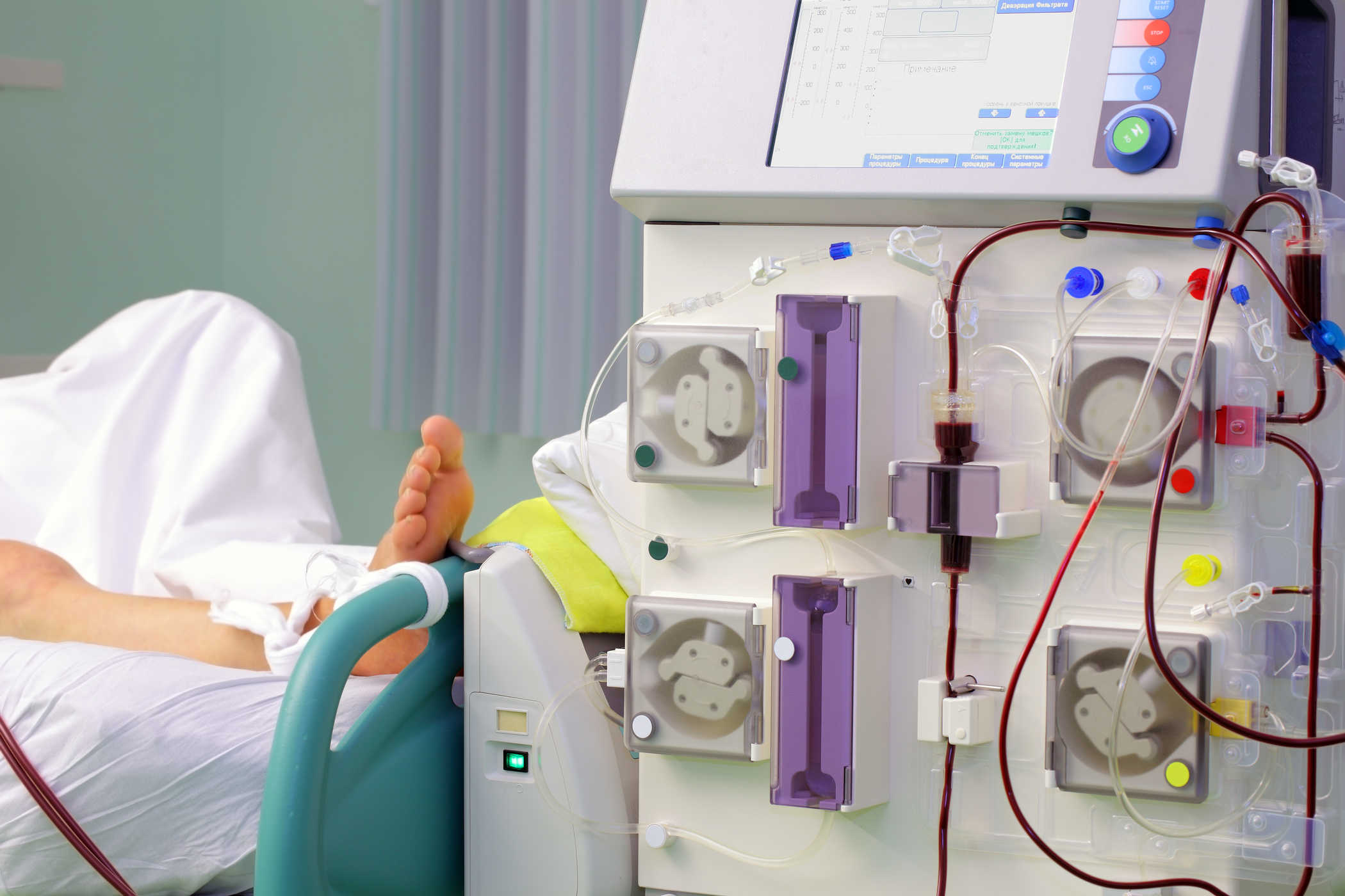 Hemodialisis, Prosedur Cuci Darah untuk Penyakit Gagal Ginjal