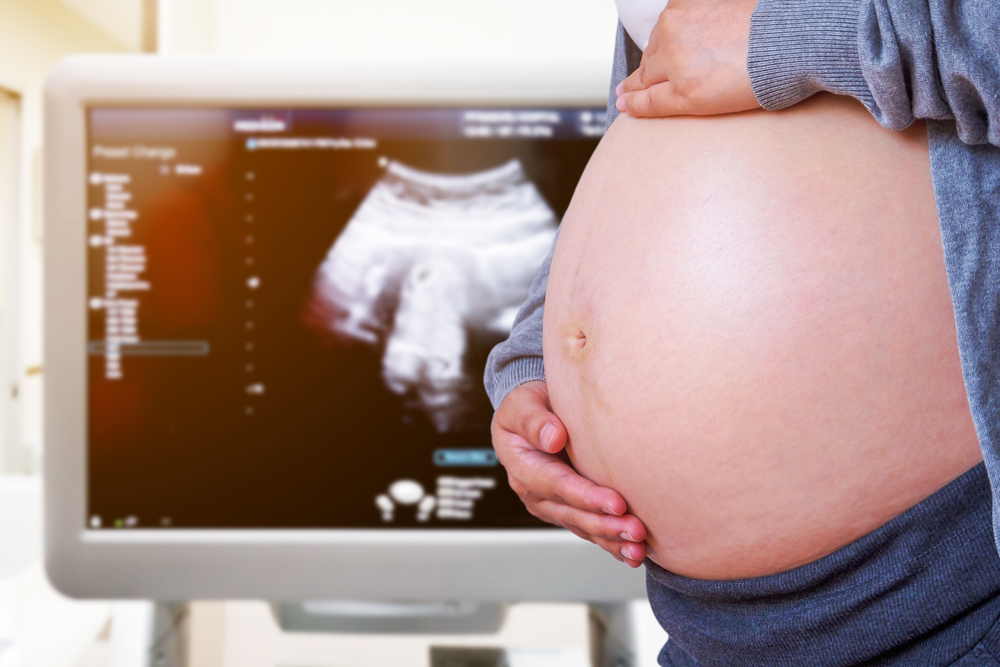 kenapa-ibu-hamil-perlu-melakukan-genetic-screening