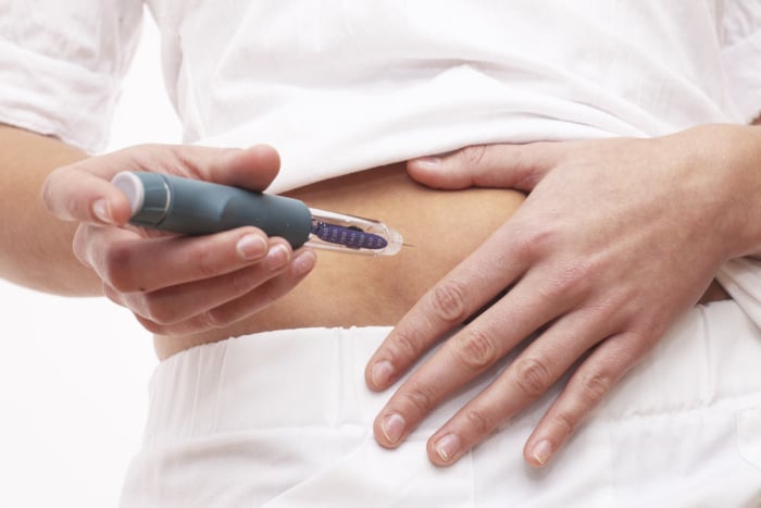 pankreas buatan diabetes tipe 1 insulin suntik