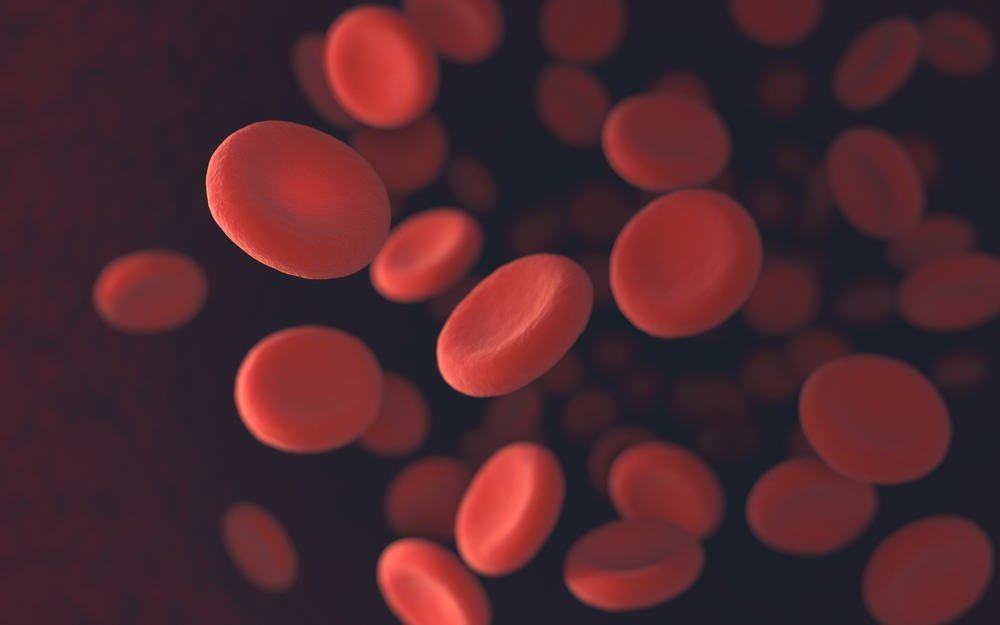 Anemia Megaloblastik