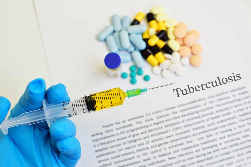 Pengobatan tuberkulosis