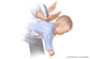 Langkah menolong bayi yang tersedak (1-3) sumber: www.webmd.com