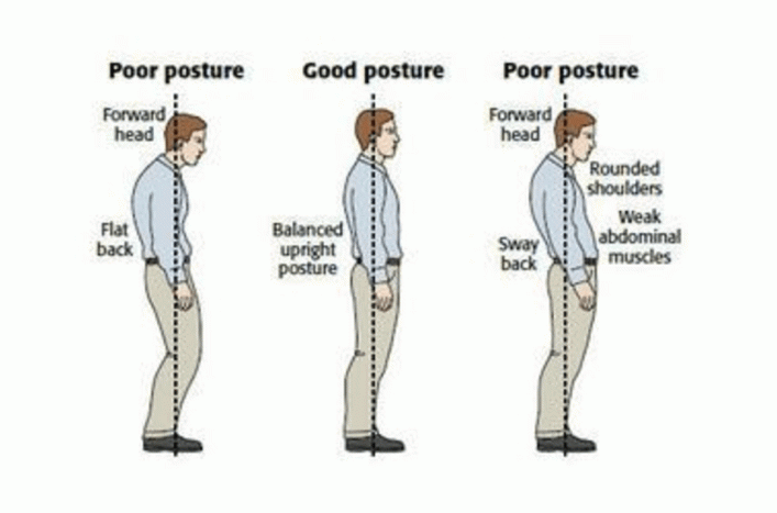 4 Health Problems Due to Bad Posture • Hello Sehat - Daily Info on Health