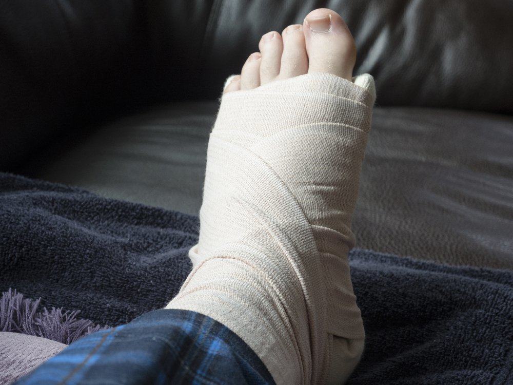 Patah Pergelangan Kaki (Ankle Fracture)