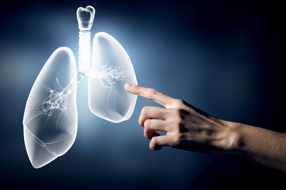 Atypical Pneumonia