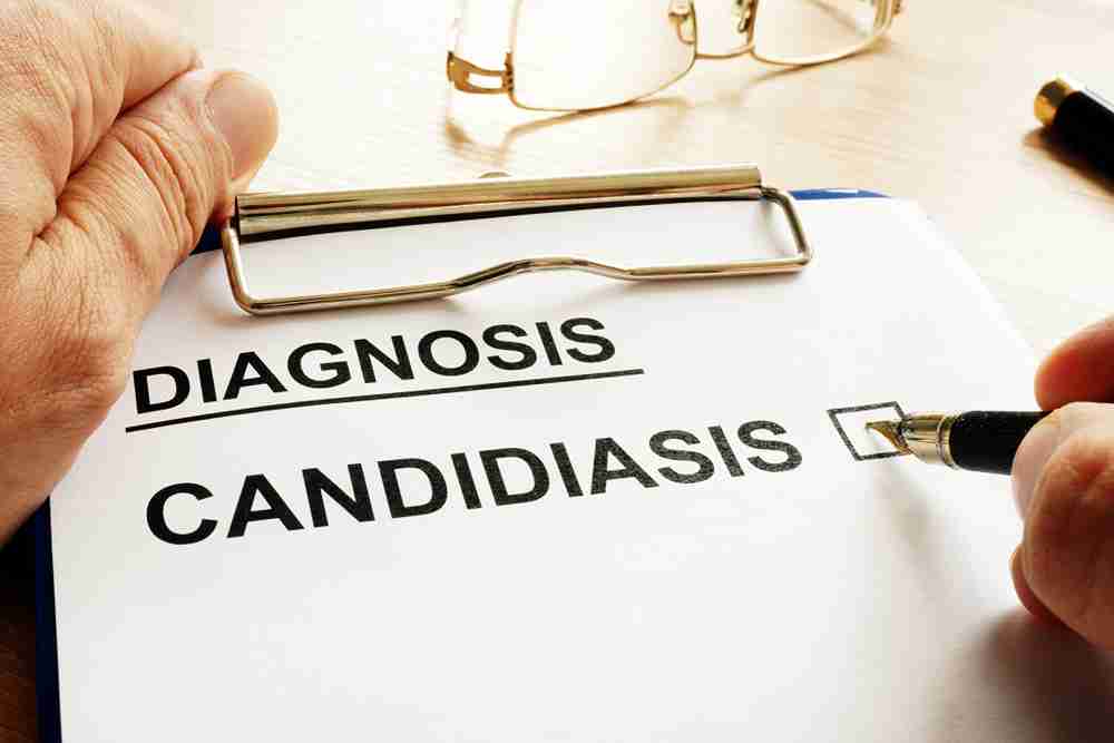 Candidiasis