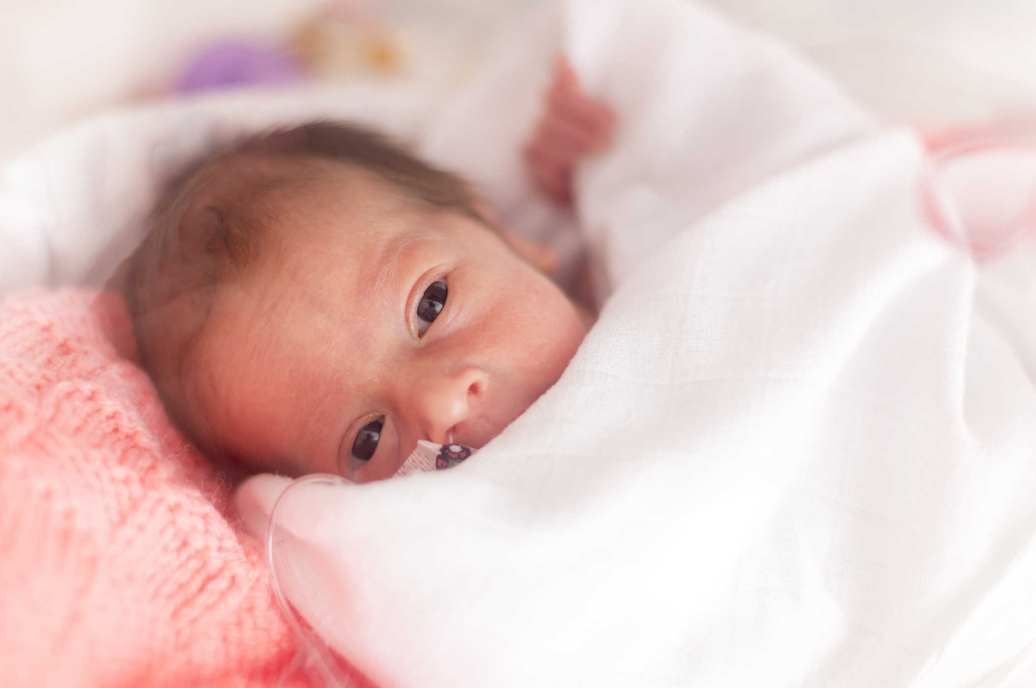Retinopati Prematuritas, Gangguan Mata Bayi yang Berisiko Membutakan