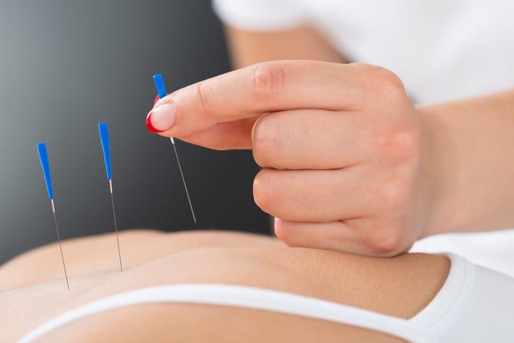 Akupuntur, Terapi Tusuk Jarum dengan 8 Manfaat