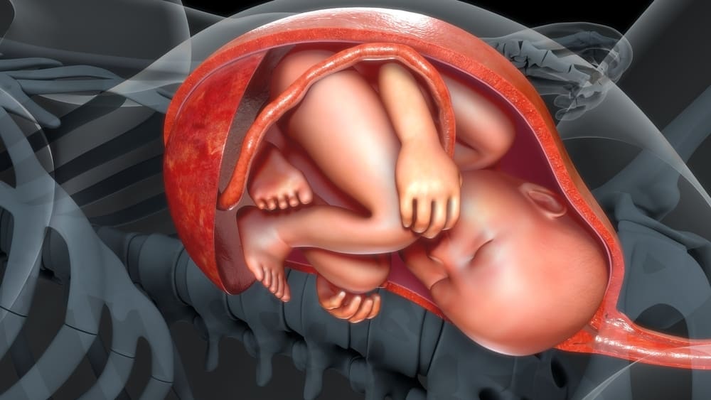 Posisi Bayi Sungsang (Breech Birth), Bisakah Lahir Normal?