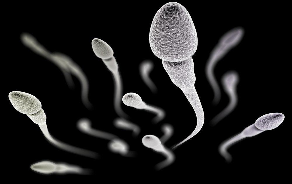 10 Kelainan Sperma yang Memengaruhi Kesuburan Pria
