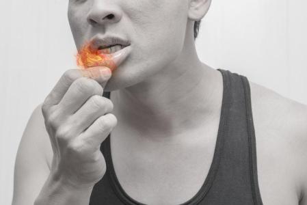Sariawan Akibat HIV: Apa Gejala dan Cara Mengatasinya?