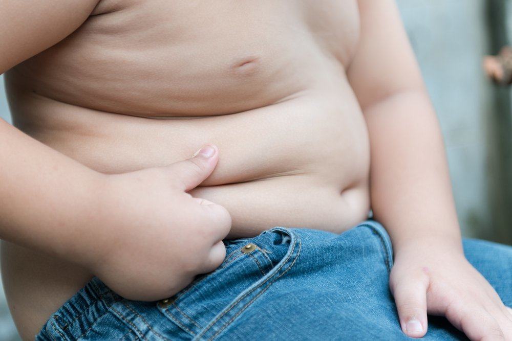 lahir caesar berisiko obesitas