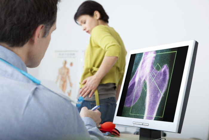 makan gula bisa osteoporosis