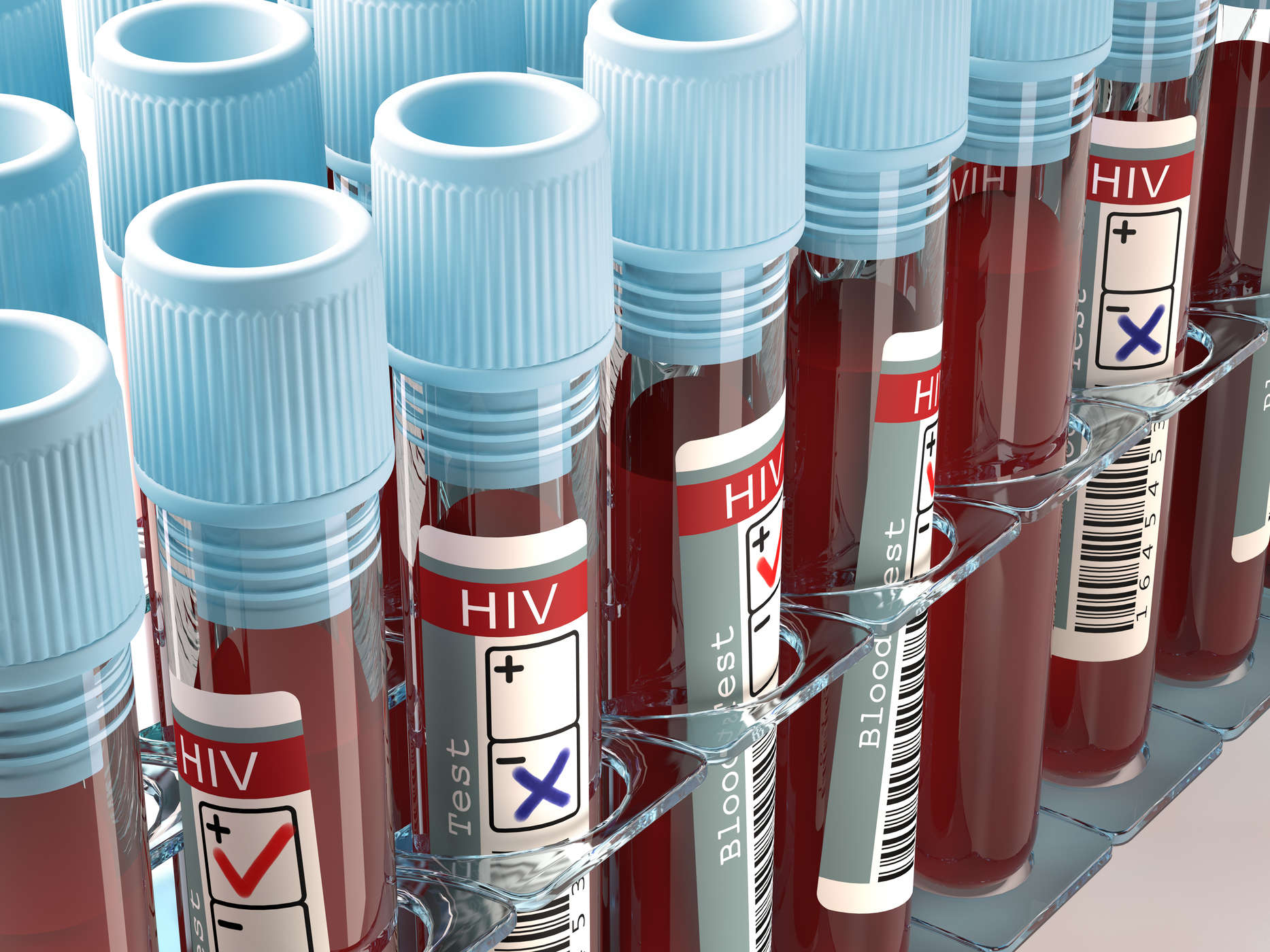 Apakah Saya Berisiko Terinfeksi HIV? Waspadai Berbagai Penyebab HIV AIDS
