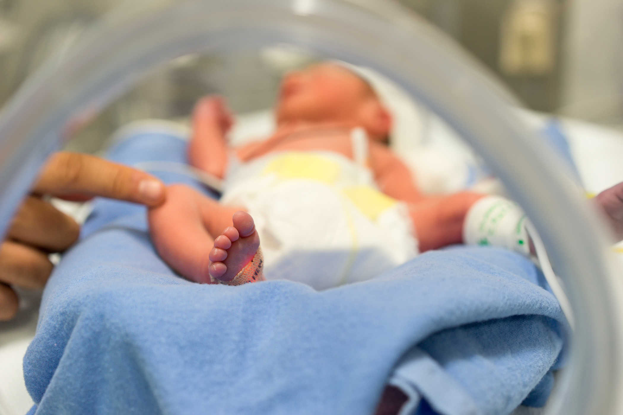 5 Masalah yang Biasa Terjadi Pada Anak yang Lahir Prematur