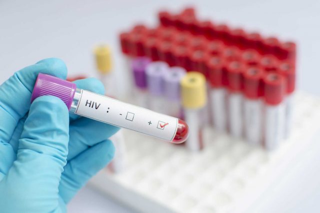 Ibu yang Mengidap HIV, Apakah Boleh Menyusui?