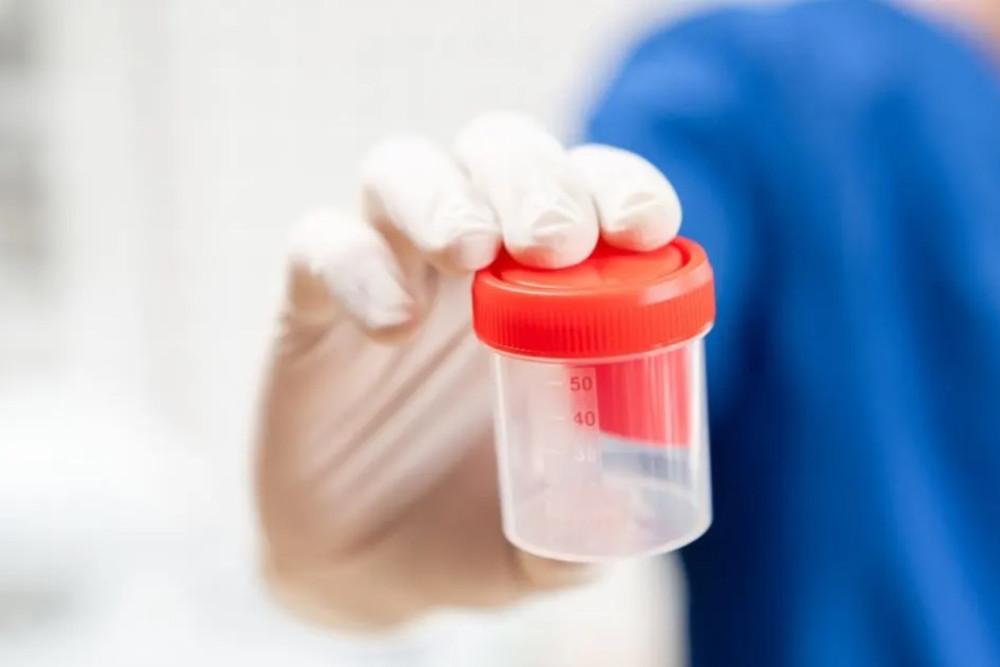 5 Ciri Sperma Tidak Sehat yang Perlu Diketahui