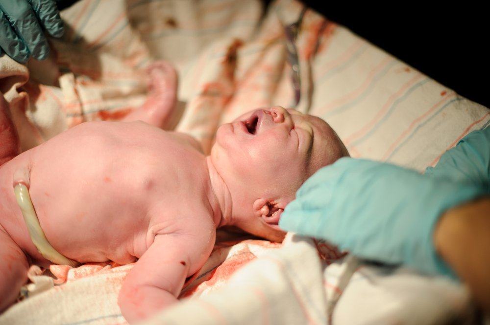 5 Cara Perawatan Tali Pusat Bayi Baru Lahir agar Cepat Kering