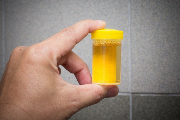 terapi urine minum air kencing