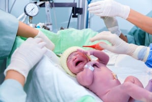 bayi yang lahir caesar mudah sakit