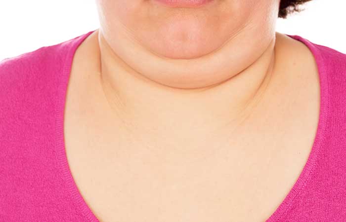 Berbagai Cara Menghilangkan Lemak di Leher (Double Chin) yang Ampuh dan Efektif